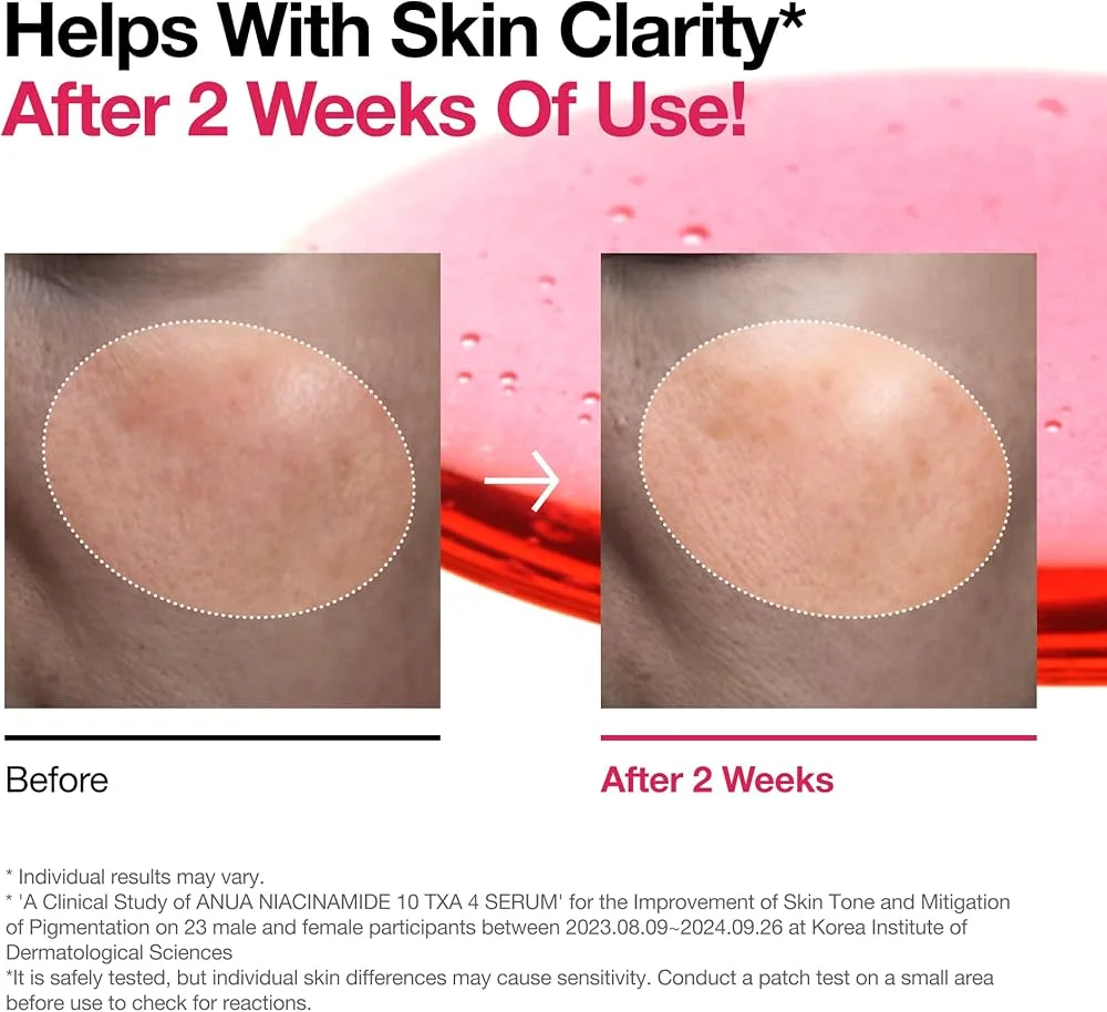 ANUA Niacinamide 10% + TXA 4% Serum