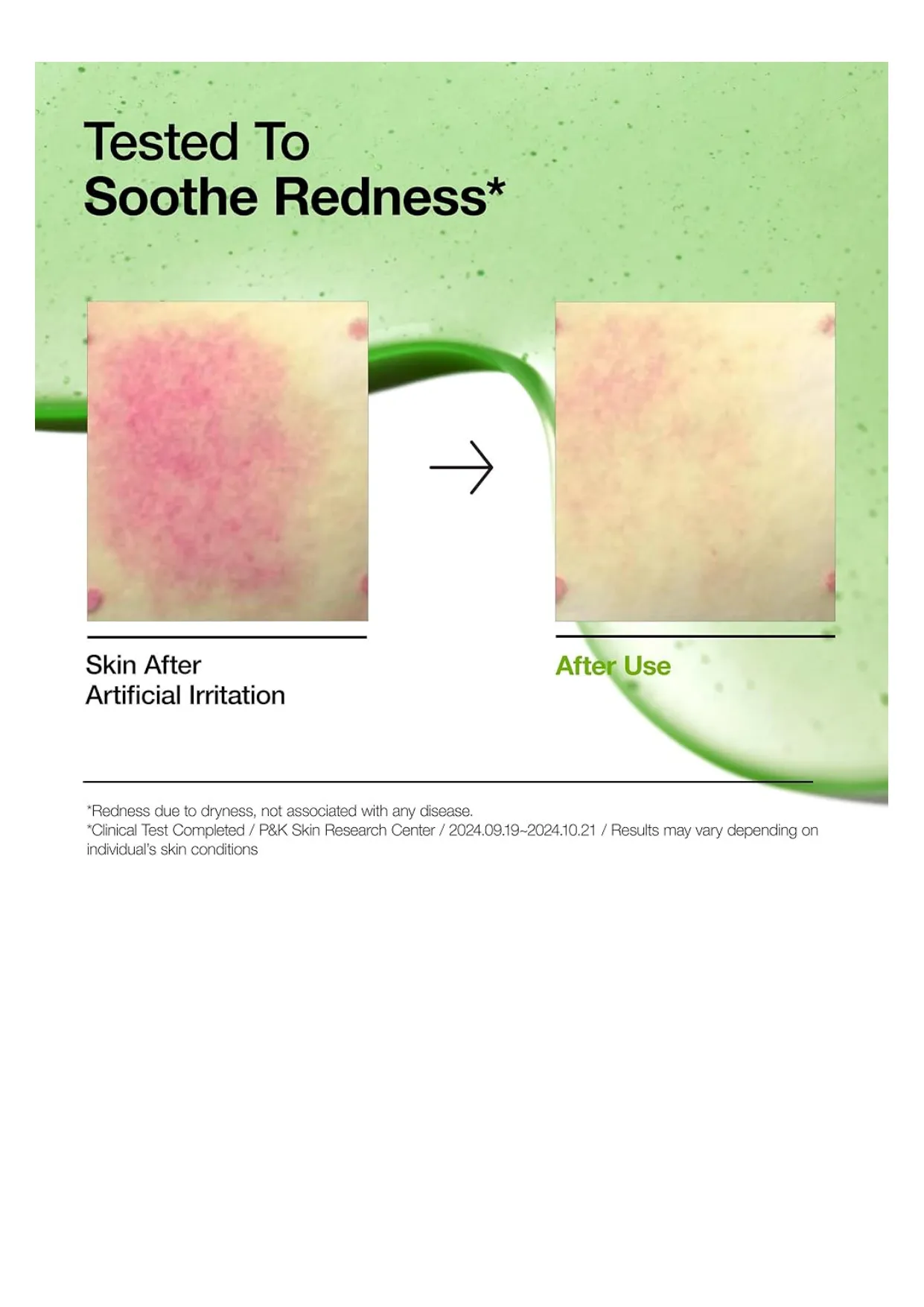 Anua AZELAIC ACID 10+ HYALURON