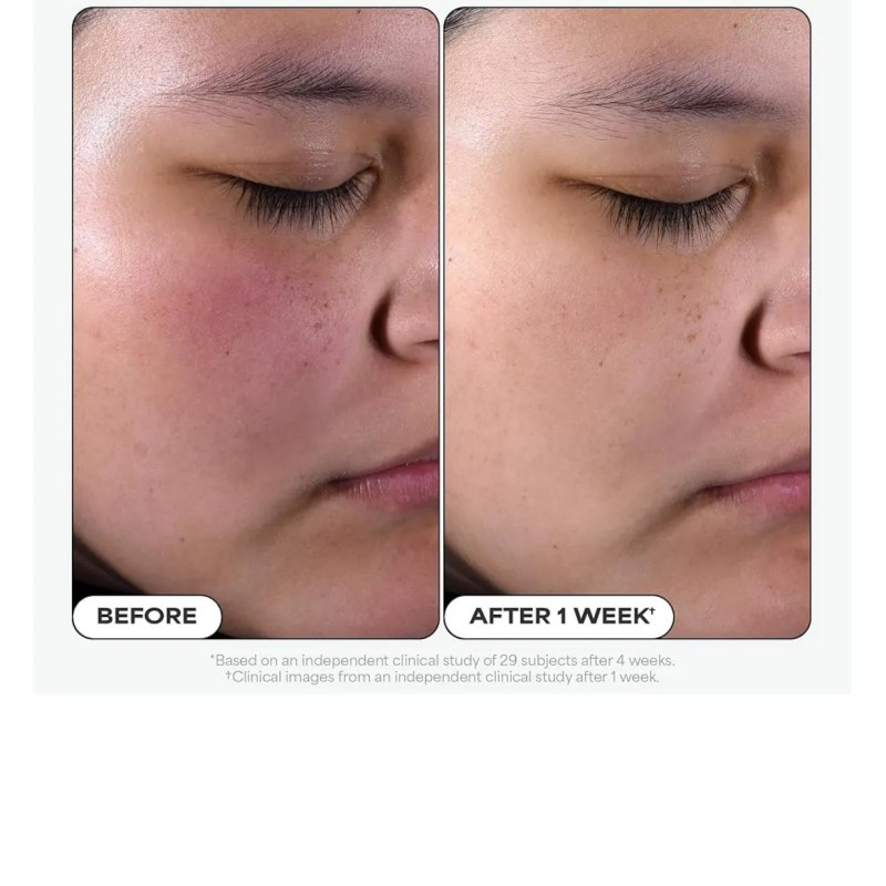 PAULA'S CHOICE 2% BHA Liquid Exfoliant