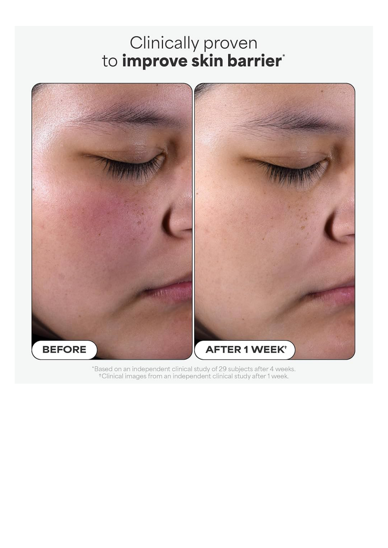 PAULA'S CHOICE 2% BHA Liquid Exfoliant