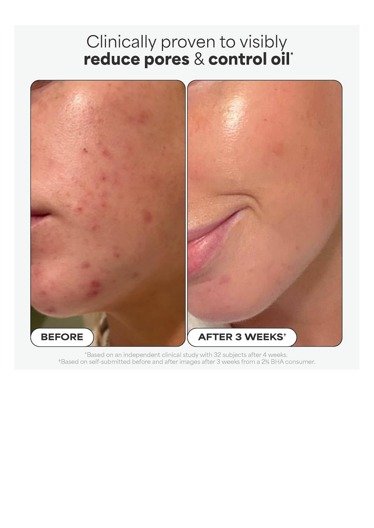 PAULA'S CHOICE 2% BHA Liquid Exfoliant