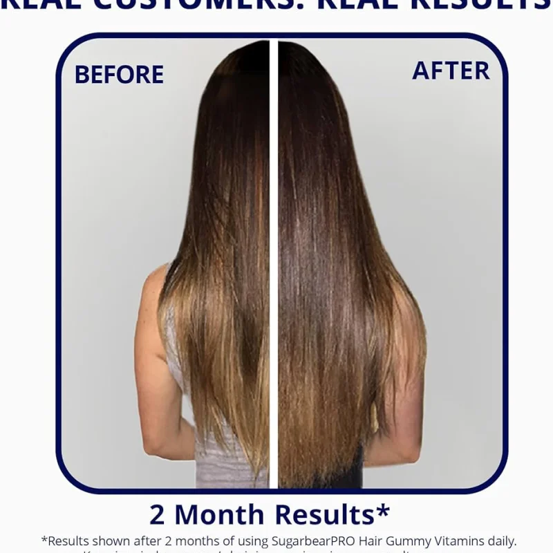 SugarBearPro Hair Vitamin Gummy 35 Day Supply, Extra Strength Biotin 6000mcg for Hair Growth, Vegan Vitamin B12, MSM, Inositol, Omega 3, Elderberry, Certified Kosher, Halal, Cruelty-Free