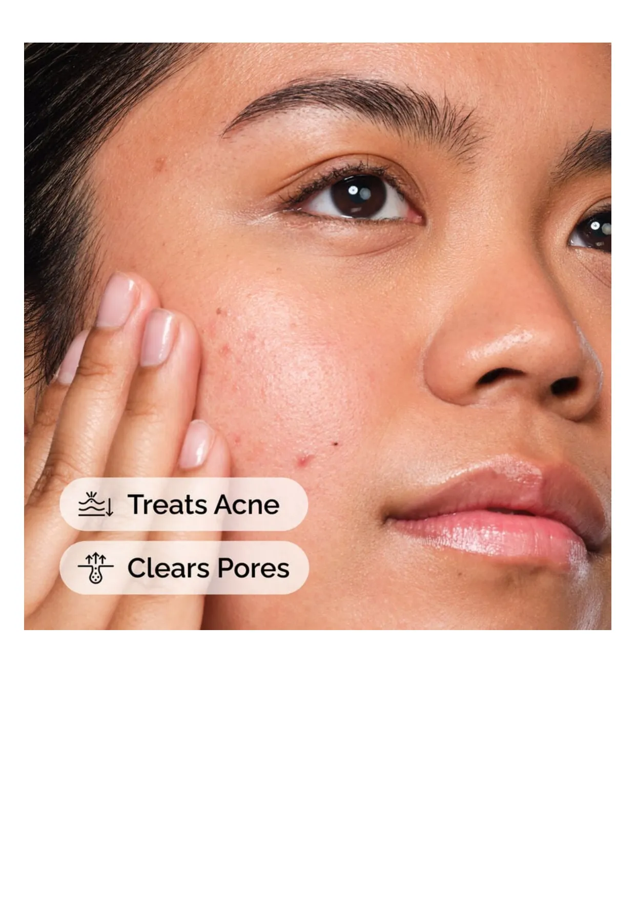 The Ordinary Salicylic Acid 2%